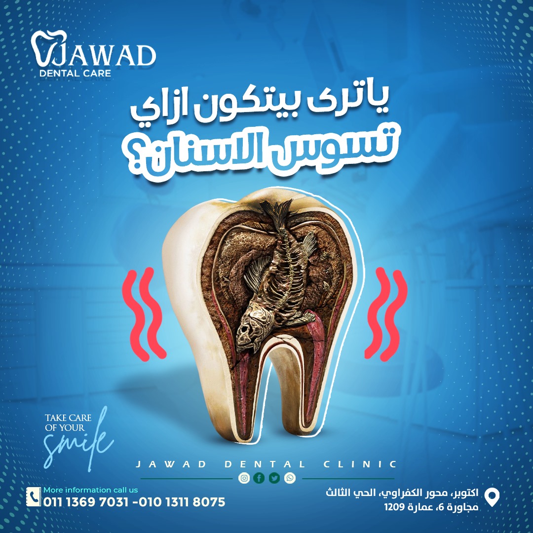 تسوس الاسنان